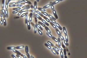 Cereulid, das emetische Toxin von Bacillus cereus