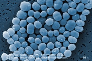<kursiv>Staphylococcus carnosus</kursiv> unter dem Elektronenmikroskop