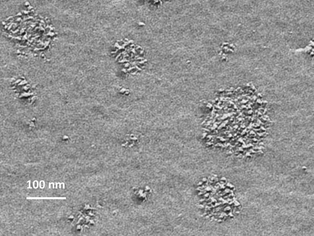 Transmissionselektronenmikroskopische Aufnahme eines Casein-Micellen-Retentats nach dreimaliger Diafiltration